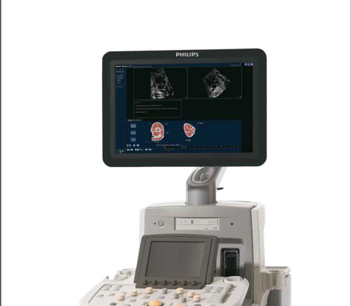 iU Elite 4D飞利浦至尊四维彩色超声诊断系统